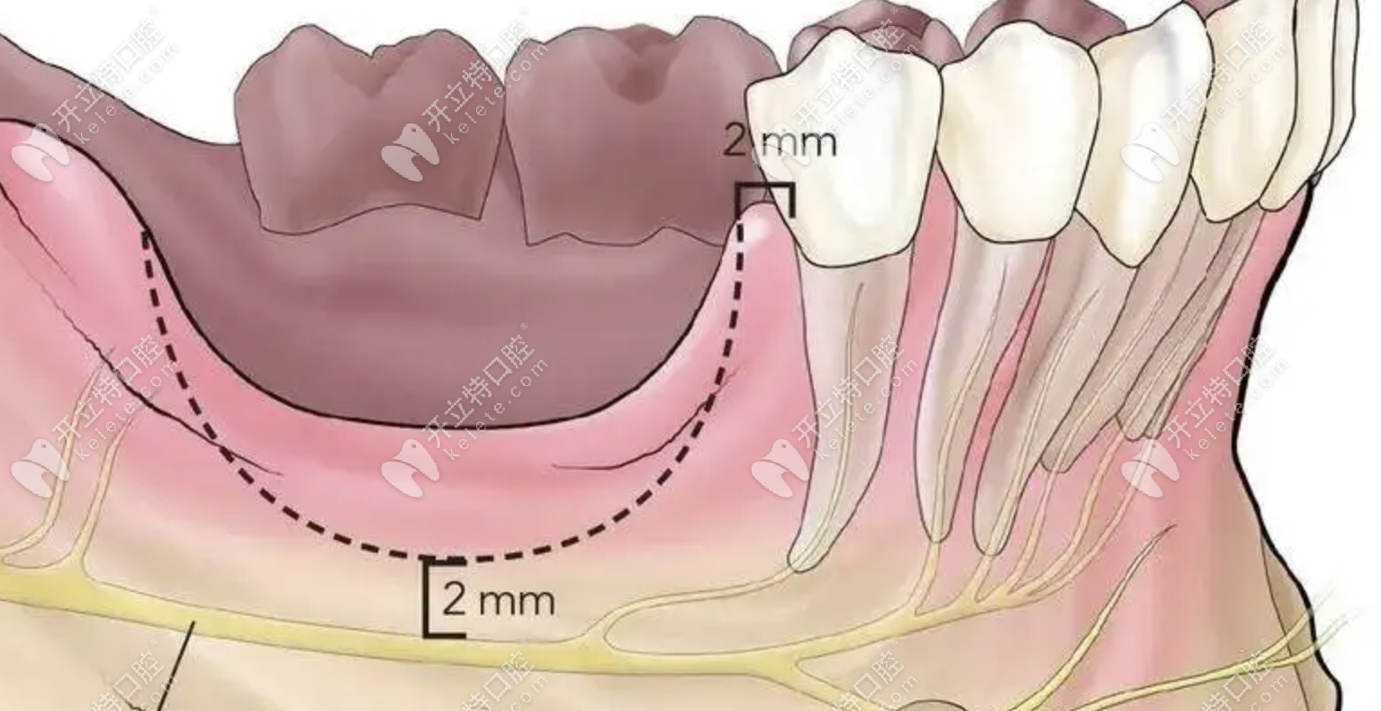 70岁牙龈萎缩假牙戴不住要及时治疗，是可以做种植牙的