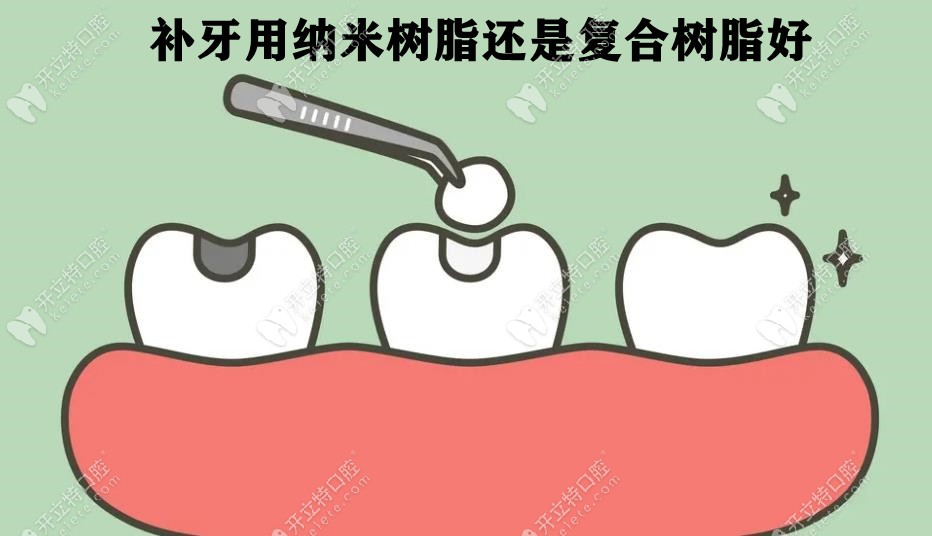 参考纳米树脂和复合树脂区别:补牙选择纳米还是复合树脂好