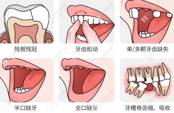 新乡红旗艾尚口腔诊疗项目