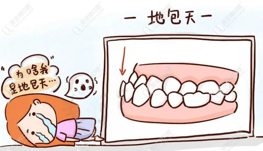 骨性地包天带牙套有效吗?只带牙套不正骨需看重度程度划分