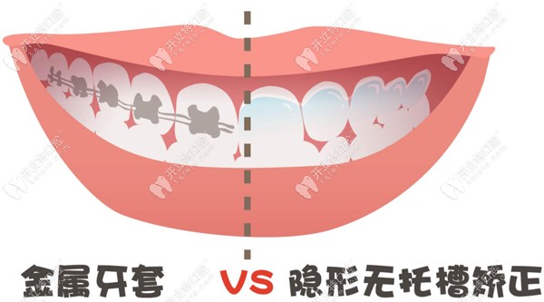 在太原矫正牙齿的收费