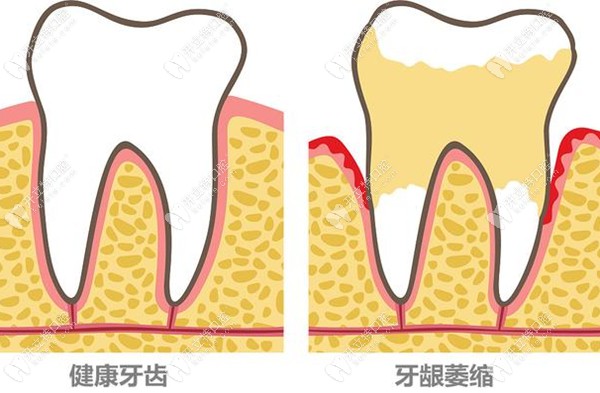 广州医院牙科综合治疗费用