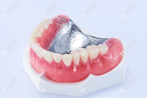 牙齿缺失的修复方式有哪几种kelete.com