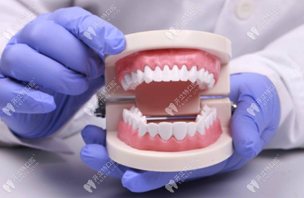 揭秘软体植牙是怎么回事,及软体再植牙和常规种植牙的区别