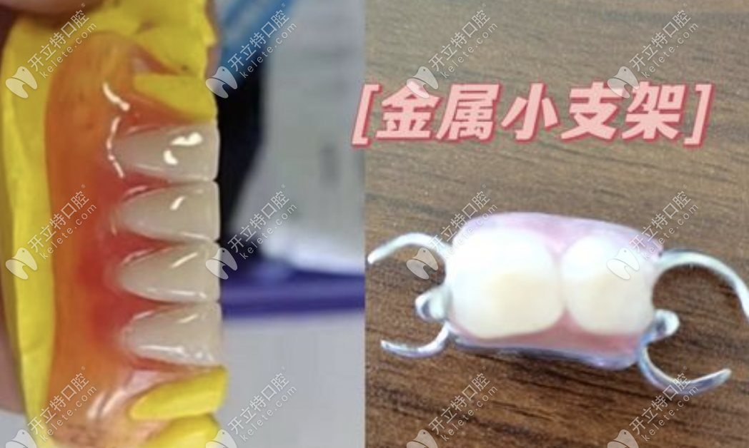 活动假牙的基托比较小