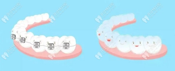 牙祖口腔矫牙福利