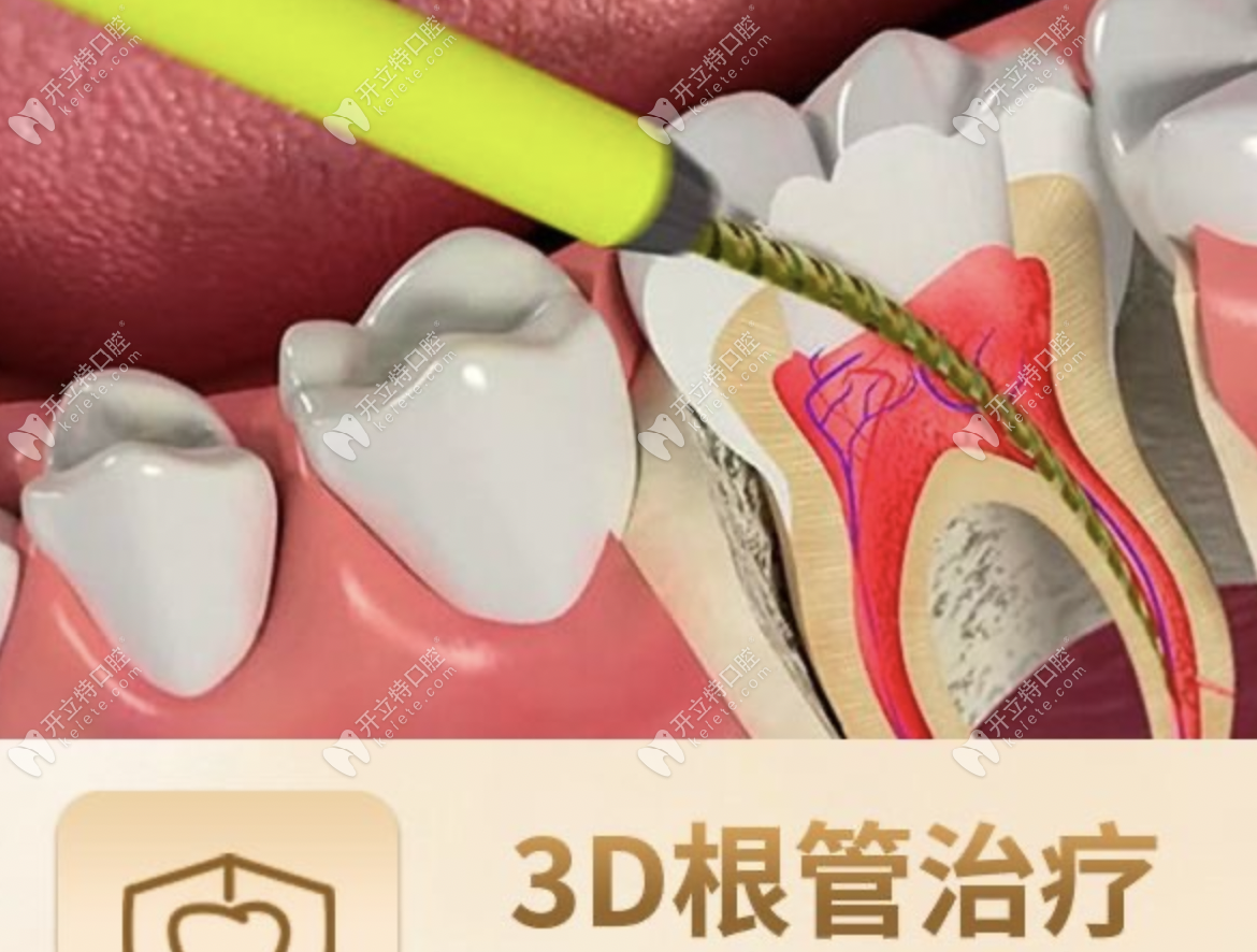 婁底八顆牙口腔口腔項目