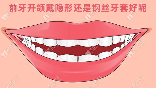 前牙开颌戴隐形还是钢丝牙套好呢?主要难度在是骨性or牙性