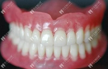 活动义齿和固定义齿的区别www.kelete.com