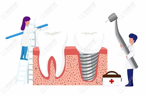 种植牙植入牙根后需要注意什么