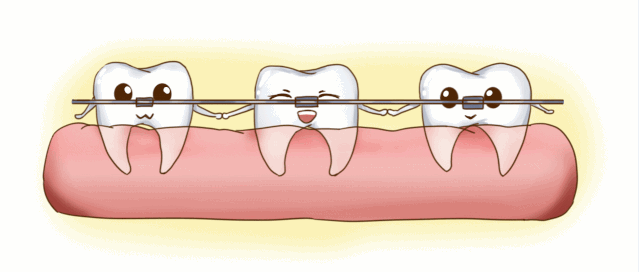 矫治器的特点帮你来选择牙套