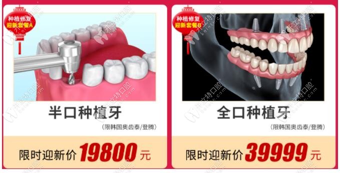广州广大全口种植牙39999元起