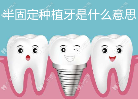 半固定种植牙是什么意思？