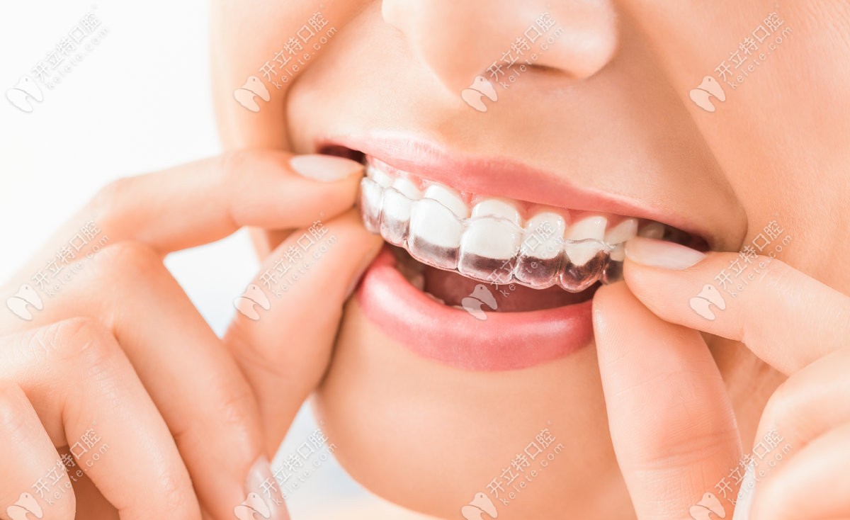 戴隐适美牙齿松动是正常吗？