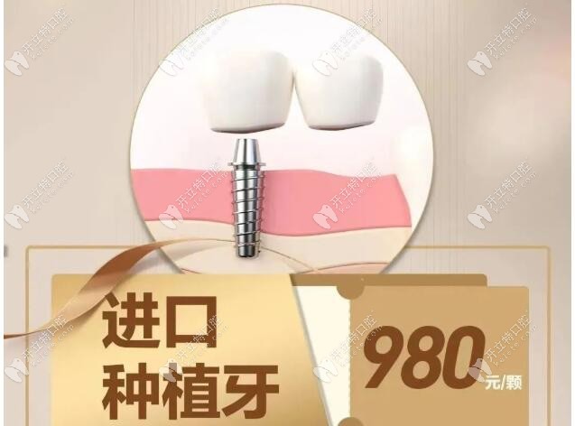 广州增城德伦口腔种牙一般多少钱?首颗进口种植牙980元起