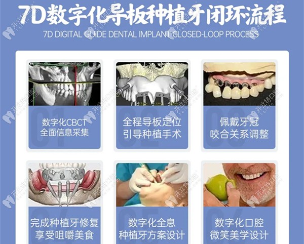 团圆口腔的数字化种植牙流程
