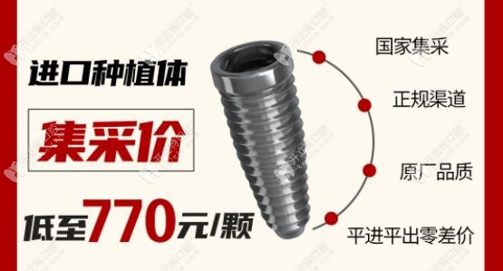 廈門麥芽口腔種植牙集采價(jià)格