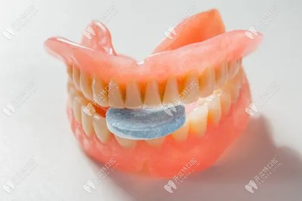 无种植仿生牙是不是假牙?是假牙,它与种植牙的区别在于...