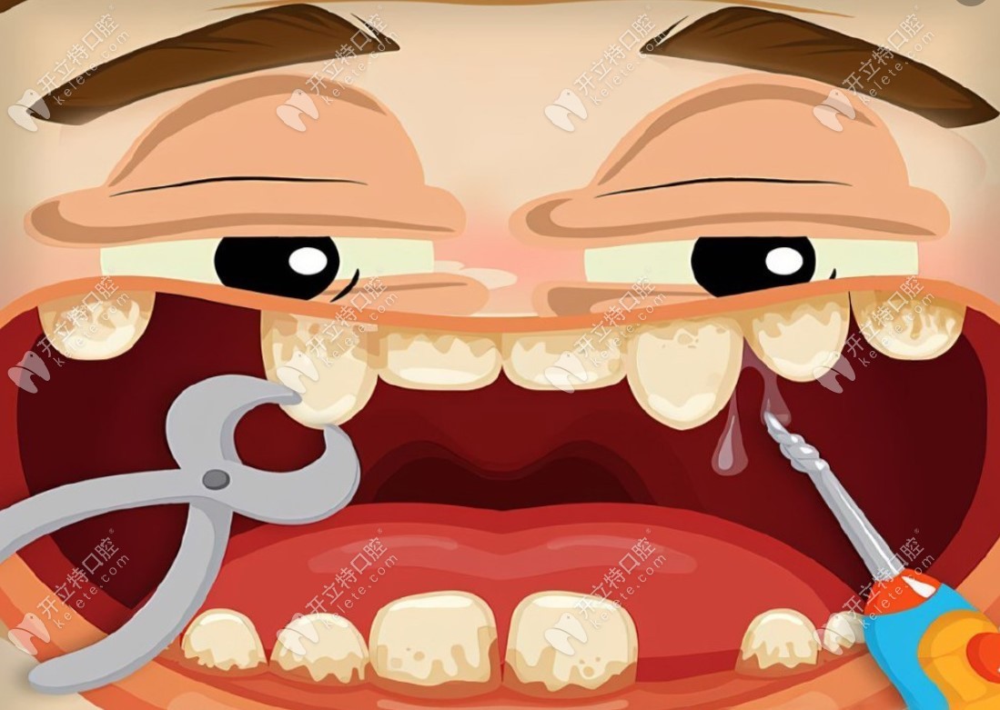 牙齿修复方式根据牙齿情况而定