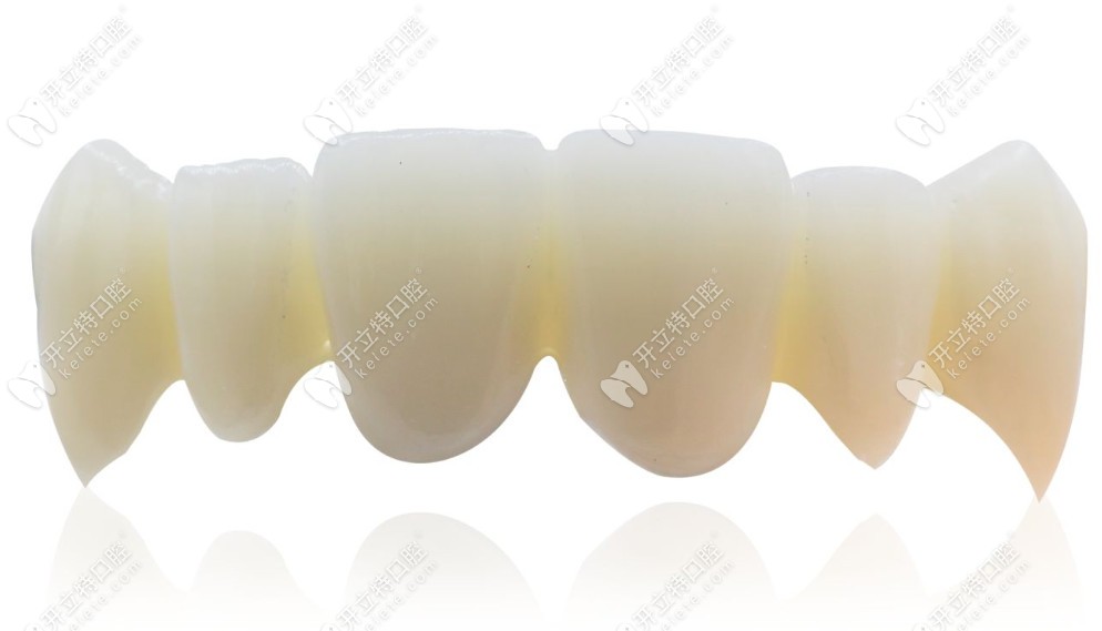 韩国登腾dentium全瓷牙冠的价格