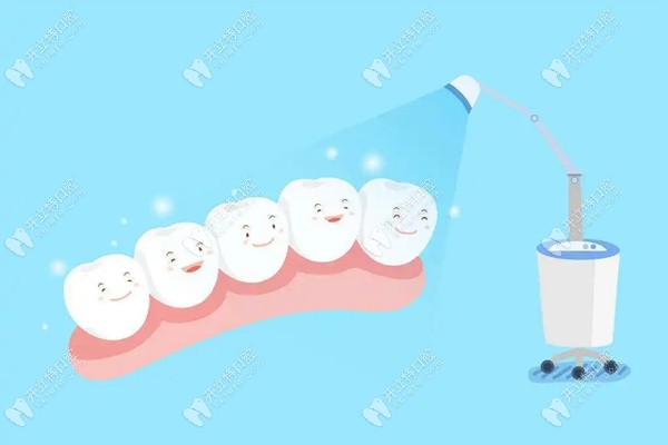 正畸过程注意清洁