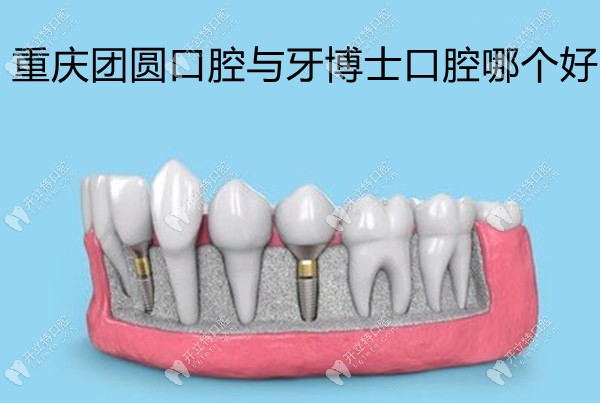 重庆团圆口腔与牙博士哪个好,同二级医院矫正种牙各有特色