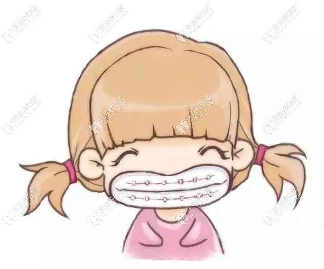 孩子牙齿畸形是什么原因造成的www.kelete.com