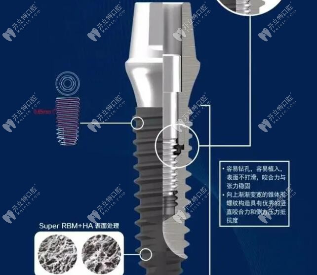 祯诺种植体的表面处理和结构