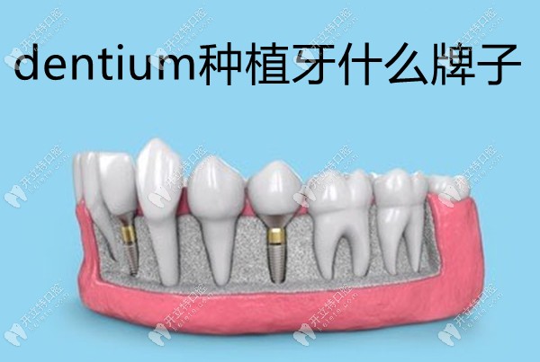 dentium种植牙什么牌子