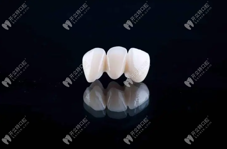 全瓷牙便宜的和贵的区别在哪www.kelete.com