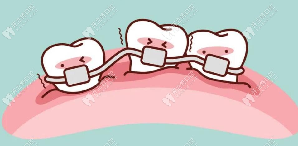 金属牙齿矫正症状