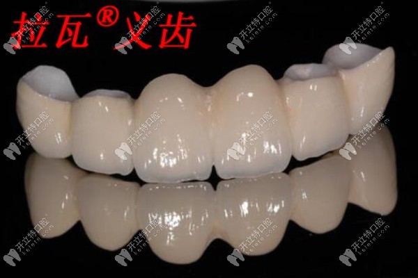 3m拉瓦全瓷牙和一般全瓷牙的区别在于材质|硬度等,价格偏贵
