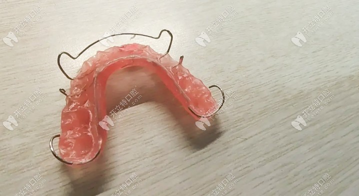 颌垫舌簧矫治器图片