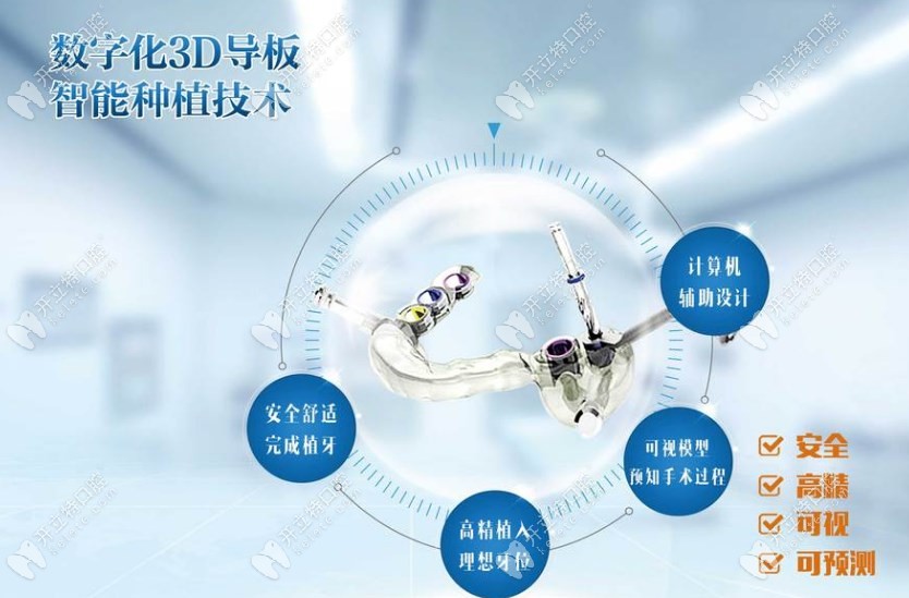 杭州美奥口腔数字化3D种植牙技术kelete.com
