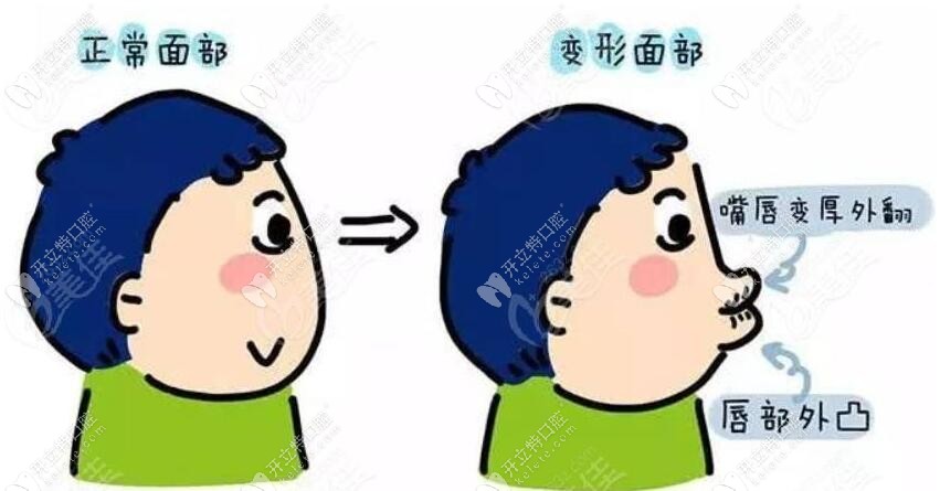 衡陽皓雅口腔兒童矯正