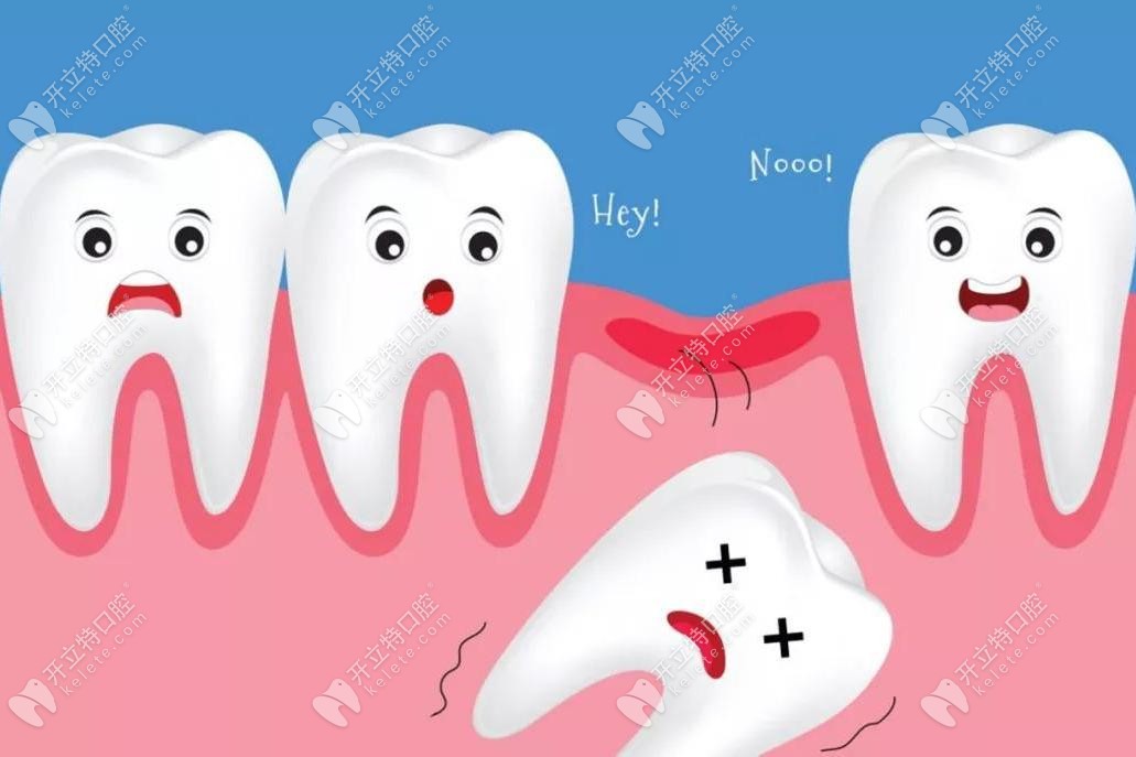 牙周炎导致的牙齿松动可以固定吗
