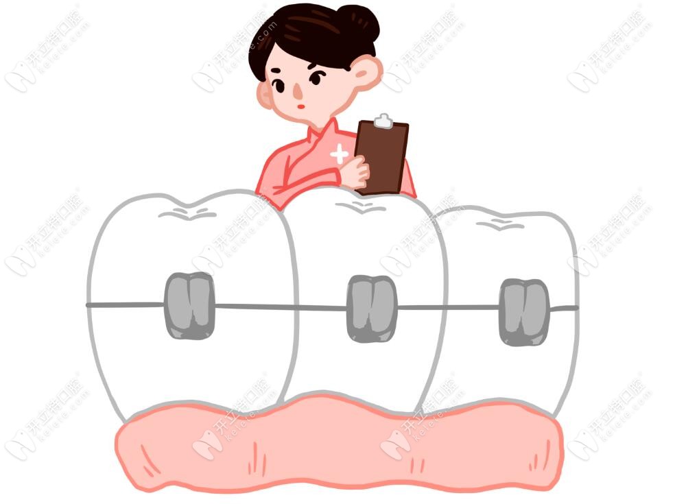 成人牙齿矫正可以使用矫正器