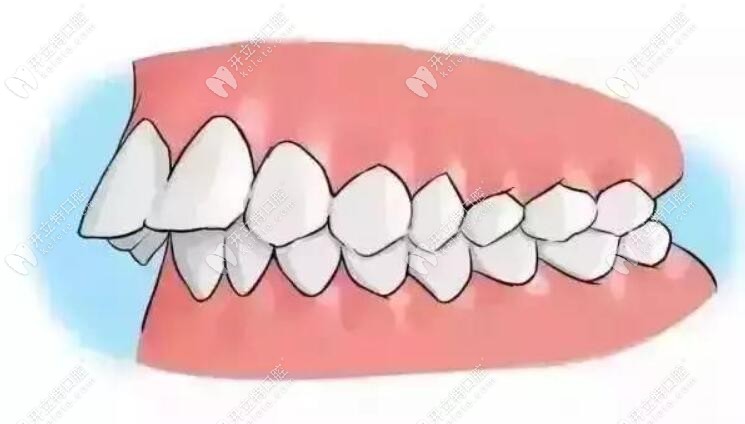牙齿的排列www.kelete.com