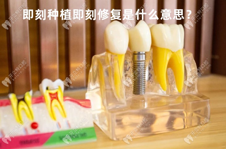 即刻种植即刻修复是什么意思?和传统种牙技术比优缺点是？