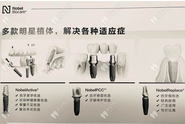 诺贝尔种植牙各型号的适应症