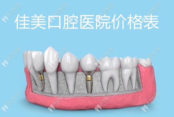 佳美口腔医院价格表:含佳美口腔修复牙300+,种植牙6160+,矫正..