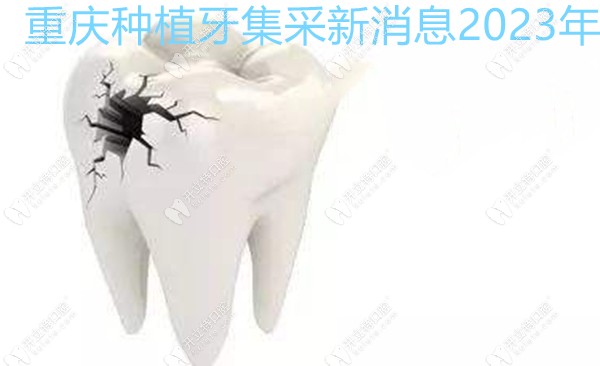 重庆种植牙集采新消息2023年