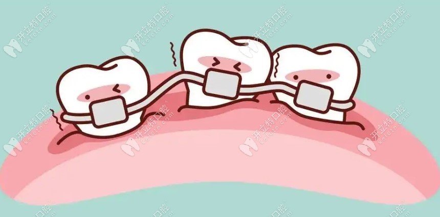 合肥儿童牙科医院收费标准：儿童牙齿矫正3500+儿童补牙150+