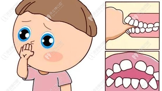 儿童口腔治疗