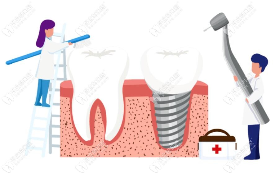 这是种植牙手术过程图