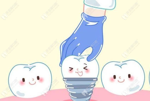 健康的牙槽骨才适合做即刻种植牙