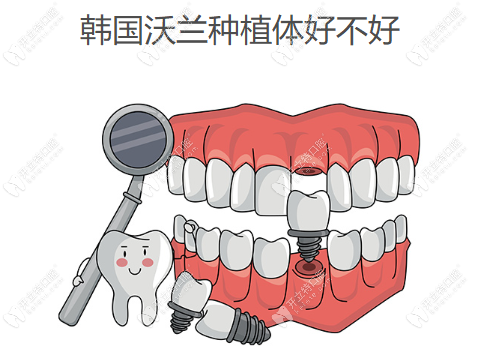 韩国沃兰种植体好不好