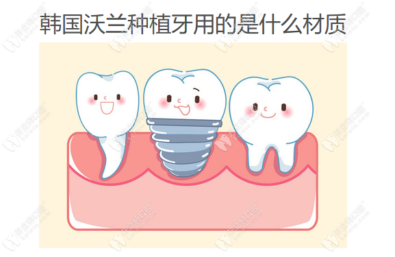 韩国沃兰种植牙用的是什么材质,4级钛材质价格在4000元起