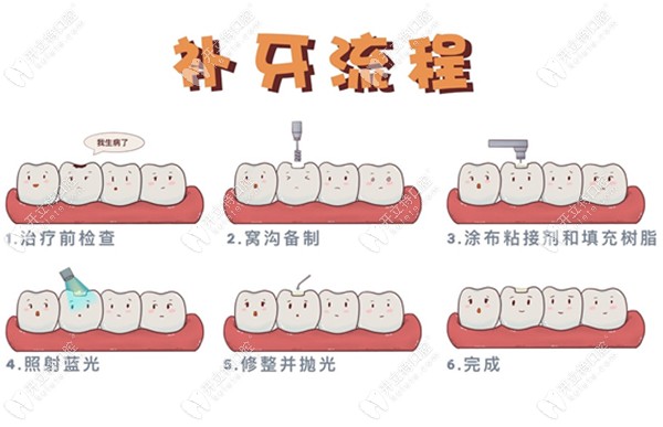 补牙的流程图片