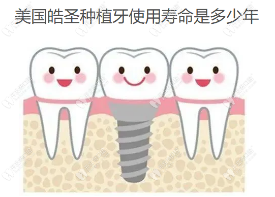 美国皓圣种植牙使用寿命是多少年